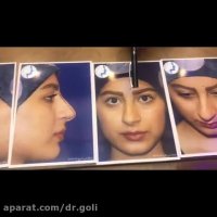 نمونه کار دکتر گلی ( قسمت اول )