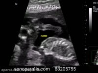 هیسسسسس نی نی میگه ساكت باشید!