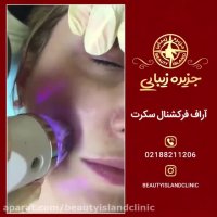 ویدیویی از آر اف فرکشنال سکرت