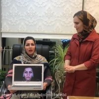 رضایتمندی از جراحی بینی بعد از 6 سال