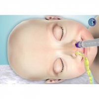 چگونه بعد از عمل زیبایی بینی آن را شست و شو دهیم؟