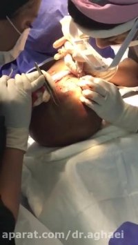 کاشت مو حرفه ای توسط دکتر حمیده آقایی