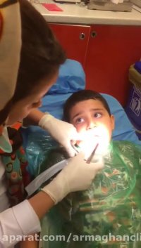 پرکردن دندان در کودکان