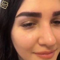 کاشت ابرو طبیعی در سعادت آباد