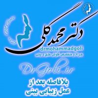 عمل زیبایی بینی توسط دکتر محمد گلی