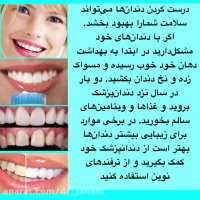 لمينت دندان