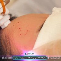 آر اف فرکشنال - 02632402304