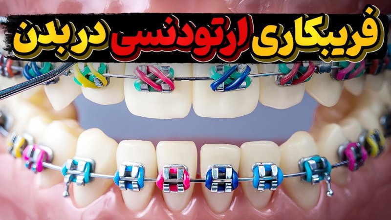 فناوری فریب بدن توسط ارتودنسی چطوری کار میکنه؟