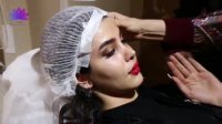 لیفت ابرو در کلینیک تخصصی ارکیده