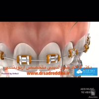 بهترین متخصص ارتودنسی