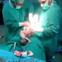 به دنیا امدن چهارتا بچه