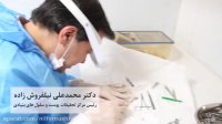 تولید موی انسان در آزمایشگاه برای اولین بار در ایران (دکتر نیلفروش زاده)