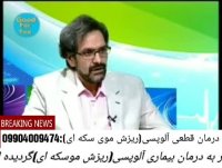 بیماری آلوپسی درمان شد نگران نباشید(کارشناس:امیری)