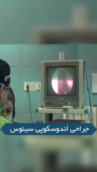 فیلم جراحی اندوسکوپی سینوس خارج کردن پولیپ