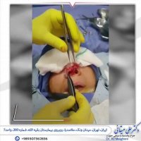 فیلم جراحی ترمیمی بینی