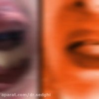 ایمپلنت دندان