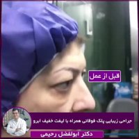 جراحی زیبایی پلک و لیفت ابرو