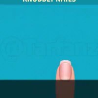 ناخن ها درمورد سلامت شما چه می گویند؟