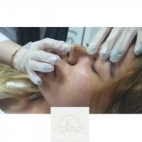 جراحی ترمیمی بینی