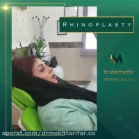 فیلم نتیجه جراحی بینی بعد از دو هفته