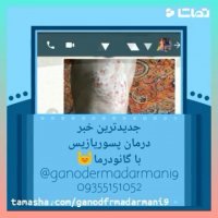 درمان شده بیماری پسوریازیس