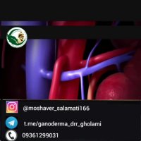 از علائم تا درمان واریکوسل