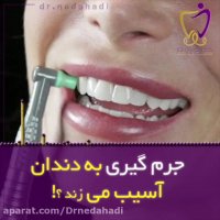 ایا جرمگیری به دندان آسیب می زند؟