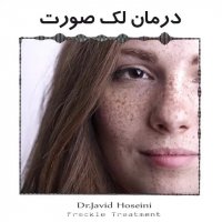 درمان لک صورت