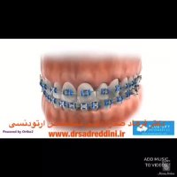 متخصص ارتودنسی در غرب تهران