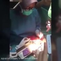 این بچه یک باتری قلمی خورده ولی ببینین موقع جراحی معده چه چیزایی درمیارن