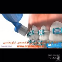 بهترین متخصص ارتودنسی