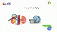علائم،علل و درمان پرمویی زائد در بانوان