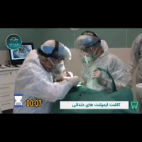 کاشت ایمپلنت دندانی