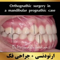 متخصص ارتودنسی | دکتر داودیان