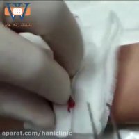 کلینیک درمان زخم هانی