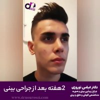 نمونه جراحی بینی دکتر  نوروزی