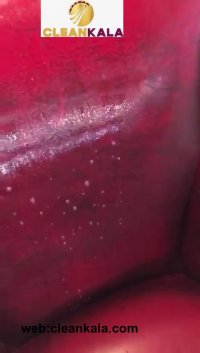 پاک کننده لکه چرم