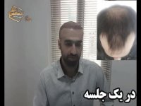 نظرات مراجعین مرکز تخصصی مو رنسانس