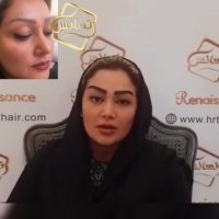کاشت ابرو رنسانس - کلینیک تخصصی رنسانس