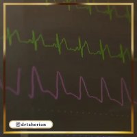 فیلم جراحی زیبایی بینی