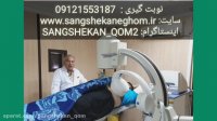 سنگ شکنی کلیه ESWL