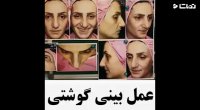 فیلم عمل بینی گوشتی