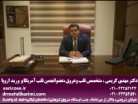 هزینه های لیزر درمانی واریس