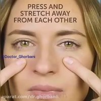 انواع سردرد