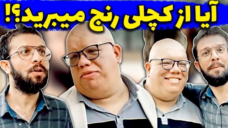 مجتبی شفیعی - آیا از کچلی رنج میبرین؟
