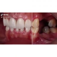 زیبایی دندان-دکترمجیدقیاسی دندانپزشک زیبایی مشهد