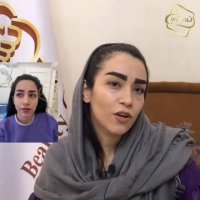 فیلم کاشت ابرو طبیعی