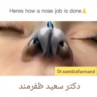 فیلم عمل بینی