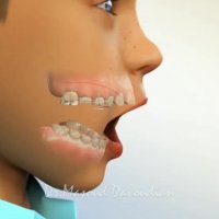 ارتودنتیست تهران | دکتر داودیان