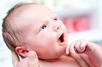 مشکلات ظاهری نوزاد بعد از تولد